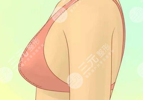 一,胸部下垂松弛手术上提需要多少钱