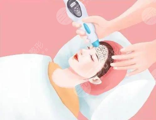 四,点阵激光案例分享