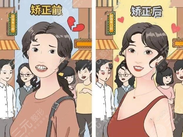 广大口腔医院牙齿矫正案例