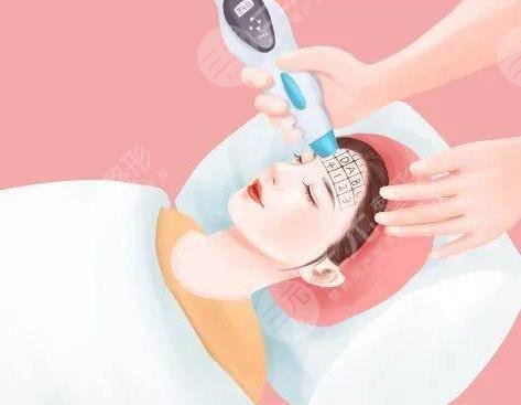 热玛吉