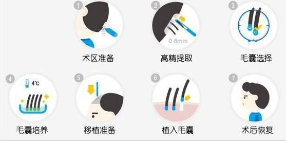 德州发际线种植要多少钱？一单位价格？植发效果可以保持多久？