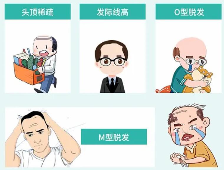 发际线种植能保持几年时间呢