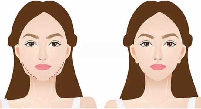 江苏省中医院马志兵注射瘦脸怎么样？医生资料信息|案例