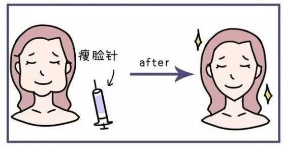 江苏省中医院整形科马志兵注射瘦脸案例分享
