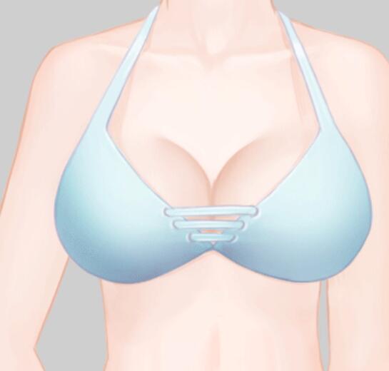 才杰隆胸技术怎么样?收费标准|隆胸经典案例图片