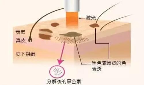 中山大学附属第一医院整形科优势项目介绍