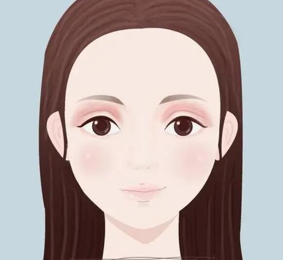广州可玉双眼皮案例分享