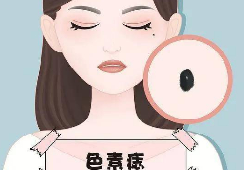 什么是注射美容和激光美容