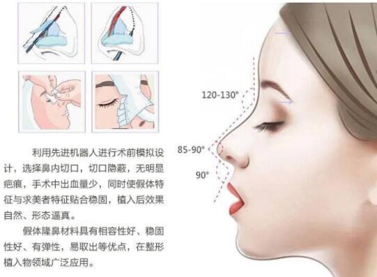 深圳鹏爱医疗美容医院隆鼻价格多少钱?