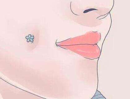常州爱芙莱玻尿酸多少钱