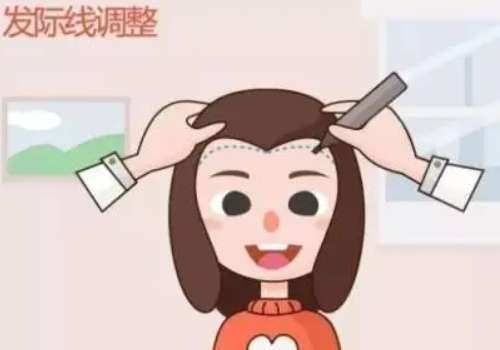 济南海峡毛发种植预约要多久