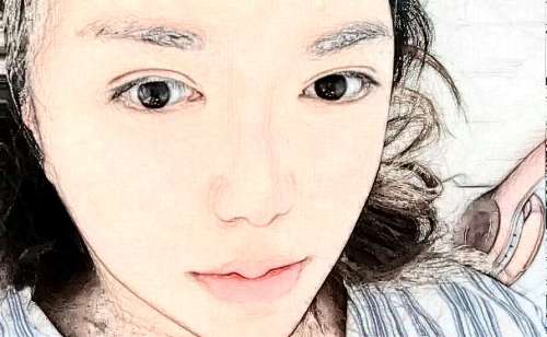 宁波美莱双眼皮价目表|手术价格各异