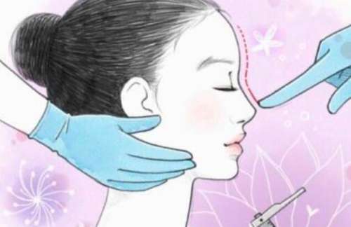 隆鼻动漫51.jpg