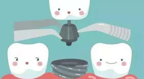 种植牙14.jpg 种植牙14.jpg