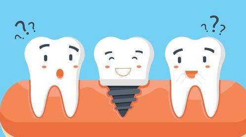 种植牙15.jpg 种植牙15.jpg