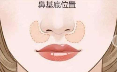 福州垫鼻基底排行前十对外公布！人气名单甄选