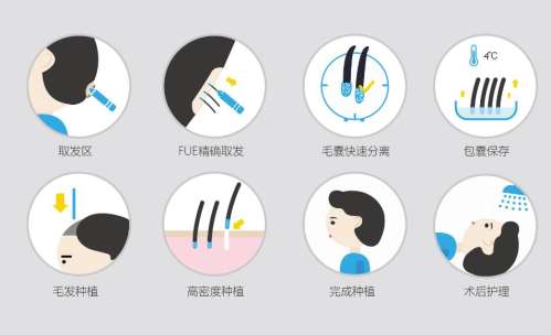 济南碧莲盛植发怎么样？院内哪位医生的技术比较好？价格表介绍